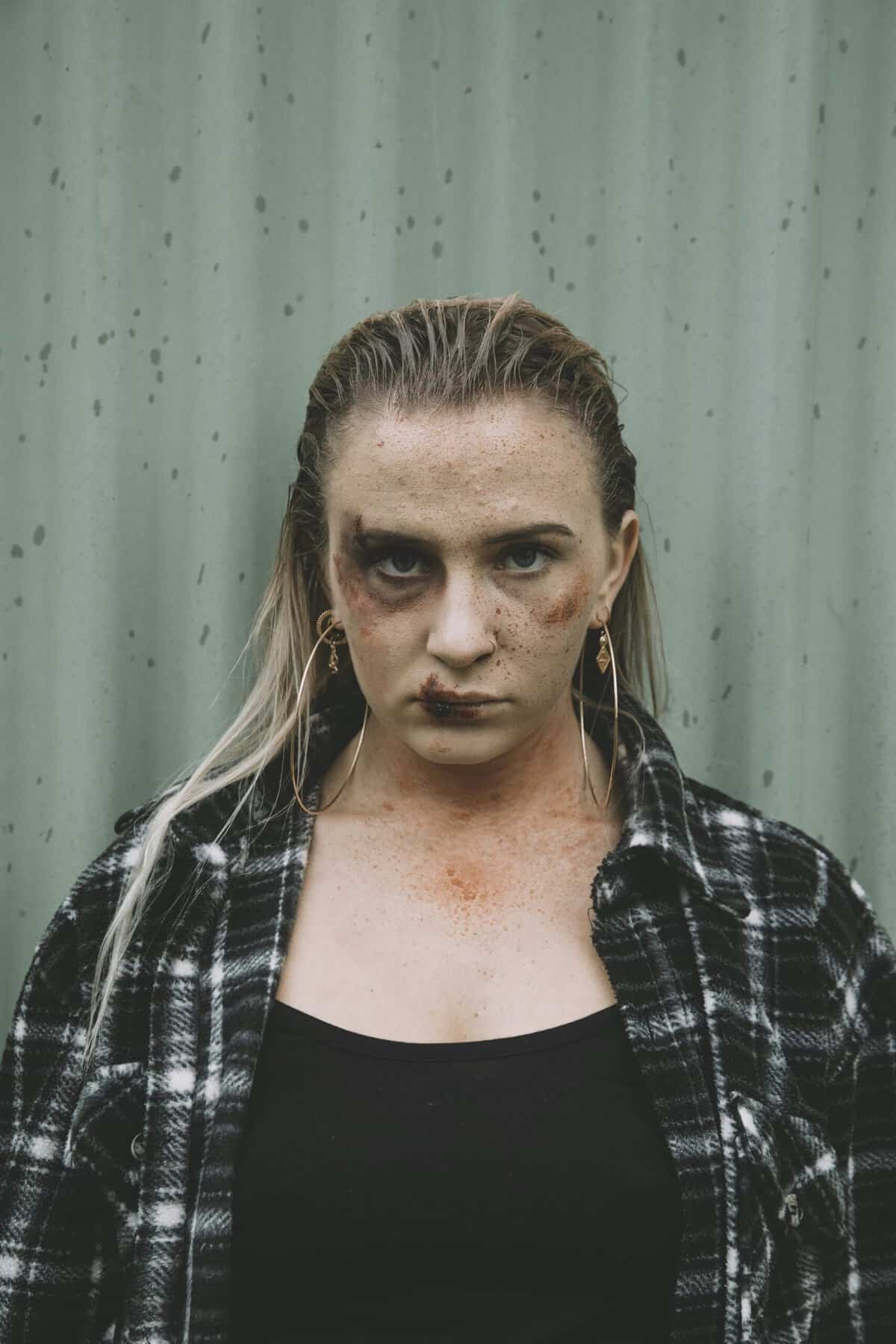 Breaking News: Paul George Injury Update